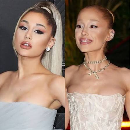 SKELETONISM: Ariana Grande shocking weight-loss concerns…